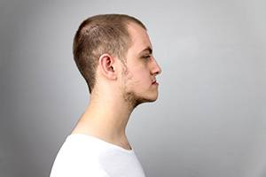 Profile portrait of young man with an underbite